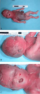 deformed-baby.png
