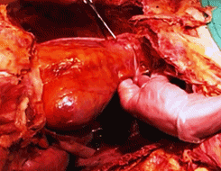 heart dissection (2).gif