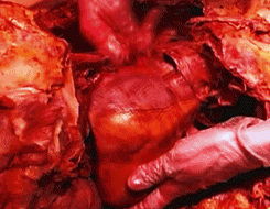 heart dissection (3).gif