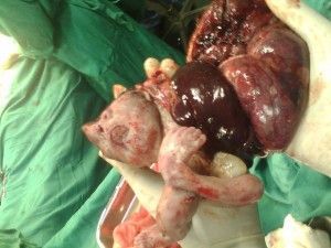 malformed-baby-300x225.jpg