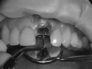 tooth proding.gif