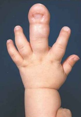 finger.jpg