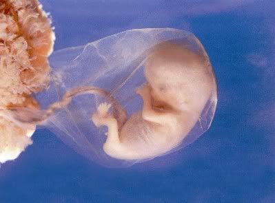 Name:  12 week.jpg
Views: 13241
Size:  17.2 KB