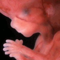 Name:  12 week one.gif
Views: 15966
Size:  17.7 KB