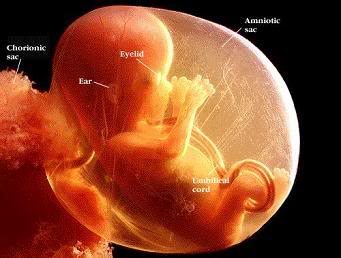 Name:  14 week.jpg
Views: 10675
Size:  16.1 KB