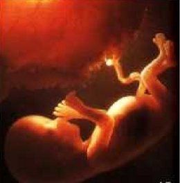 Name:  15 week.JPG
Views: 8143
Size:  9.8 KB