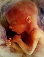 Name:  17 week.jpg
Views: 8831
Size:  6.0 KB
