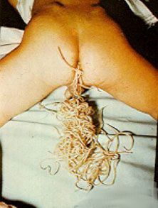 roundworms-th.jpg