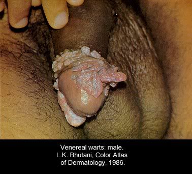 pic-dis-penis12.jpg