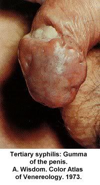 pic-dis-penis15.jpg