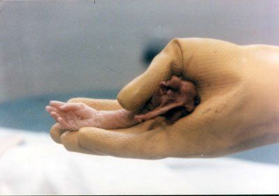 Name:  abortedbaby21.jpeg
Views: 776
Size:  14.6 KB