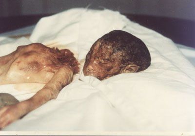 Name:  abortedbaby27.jpeg
Views: 750
Size:  15.9 KB