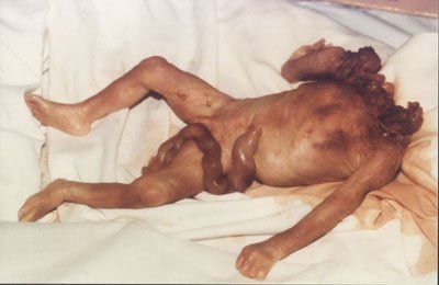 Name:  abortedbaby31.jpeg
Views: 1784
Size:  17.8 KB