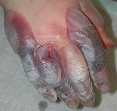 cryo%20%281%29.jpg
