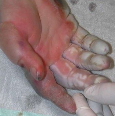 cryo%20%283%29.jpg