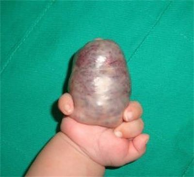 finger.jpg