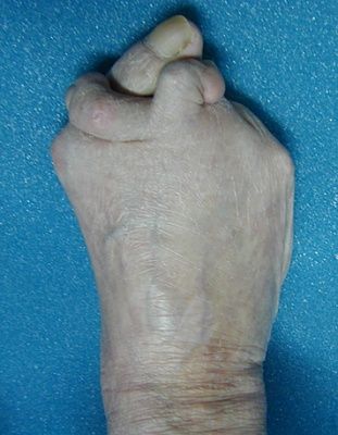 deformed-20foot.jpg