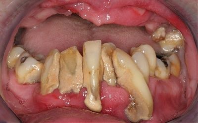 teeth.jpg