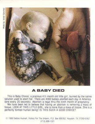 abortedbaby1.jpg