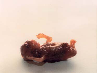 abortedbaby6.jpg