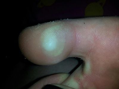 toe1.jpg