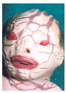 harlequin-fig1.jpg