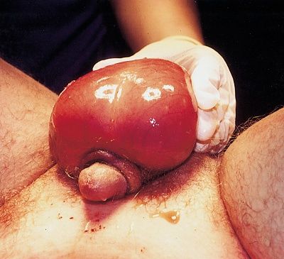scrotum.jpg