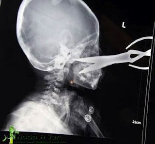 scissor2.jpg