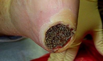heel-maggots.jpg