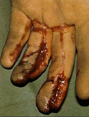 sliced-20fingers.jpg