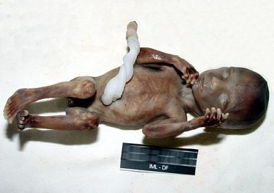 fetus.jpg