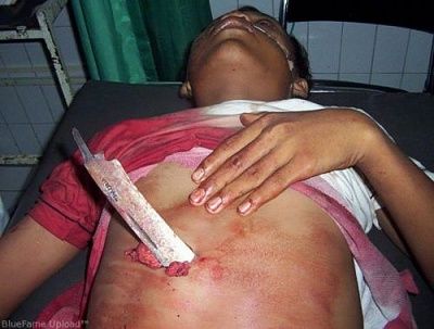 stabbed-20stomach.jpg
