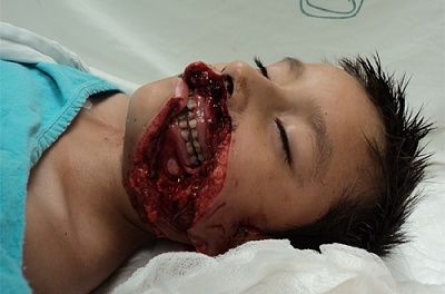 mouth-20ripped-20apart.jpg