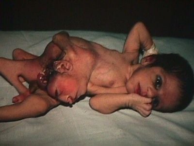 twins.jpg
