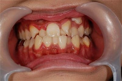 teeth.jpg