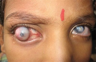 boys-20eyes.jpg