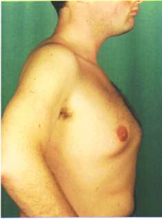 car%28pre-op%29.jpg