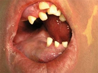 teeth.jpg