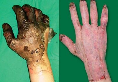 case-study-hands1.jpg