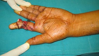 finger1.jpg