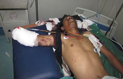 ampu1.jpg