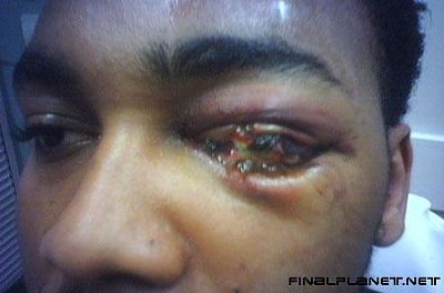 houston.eye2.jpg