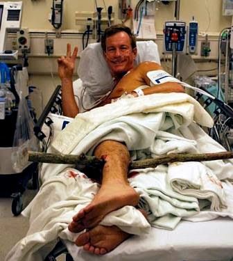 stick-leg-3-rs.jpg