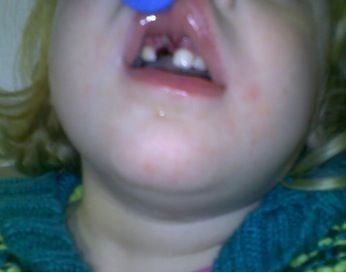 case22picturea.jpg