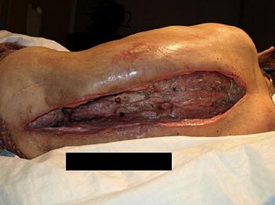 wound2.jpg