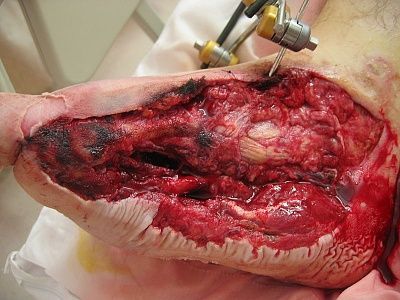foot.jpg