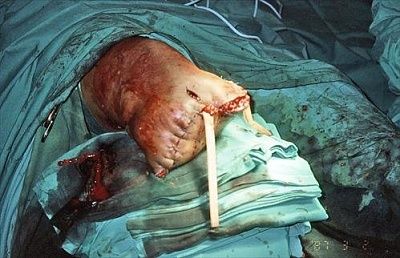 fx.openiiicfxtibia.10yom.runoveronchurchstepsbyout-controlcar.3.jpg