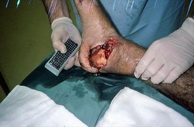 fx.opentalusdislocation.wash-out-26reduce..jpg