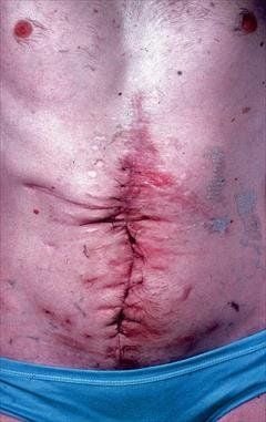 Selfmutilation.Hadalreadycutoffallhisfingersandsomeofhistoes.1.jpg
