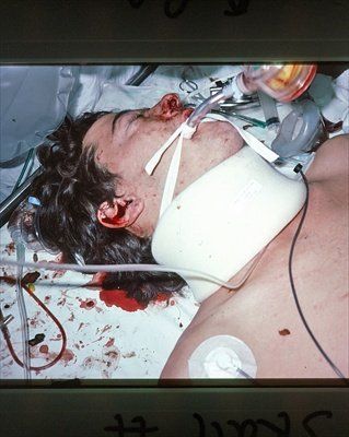 fx.basalskullfx.bloodfromear.mba.20yom..jpg